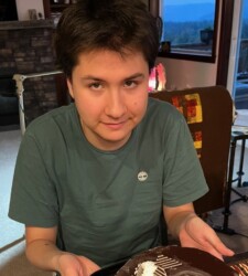 Moles on face, mole on right arm